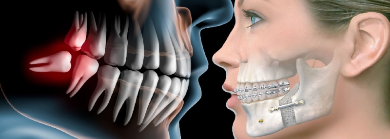 Maxillofacial Surgery