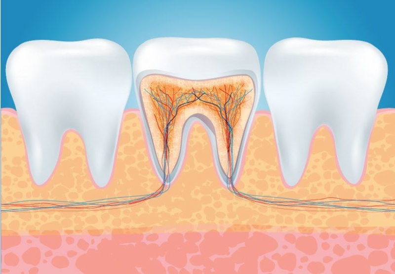 Root Canal Treatment (Endodontics)